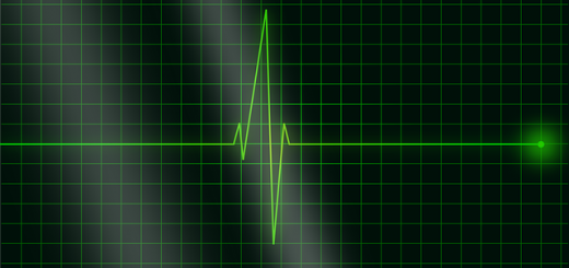 holter EKG